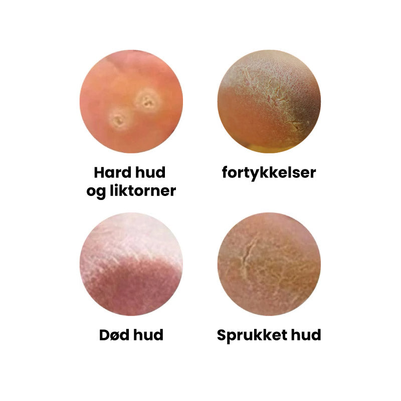 Elektrisk Fodfil - Professionel Hjemmebrug